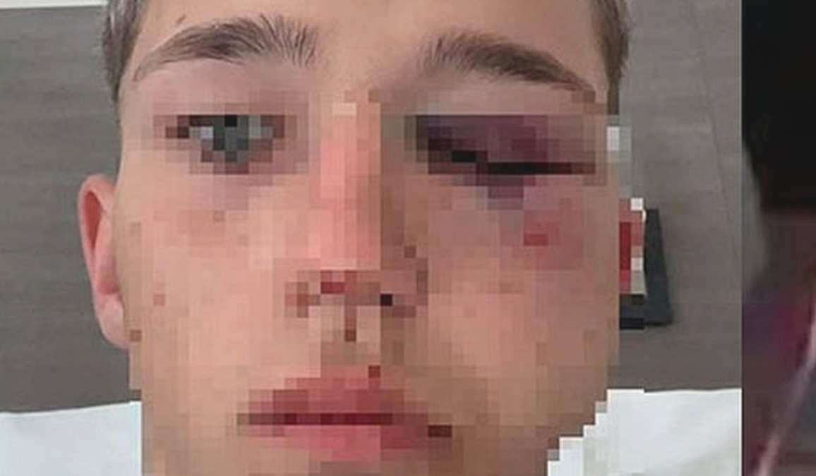 Imputarán a cuatro rugbiers en Salta por golpear a un adolescente en una fiesta | Nacionales