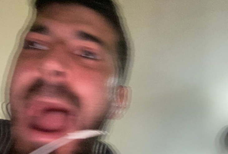 Un hombre logró capturar su expresión en el momento exacto en que se golpea el tobillo | Redes