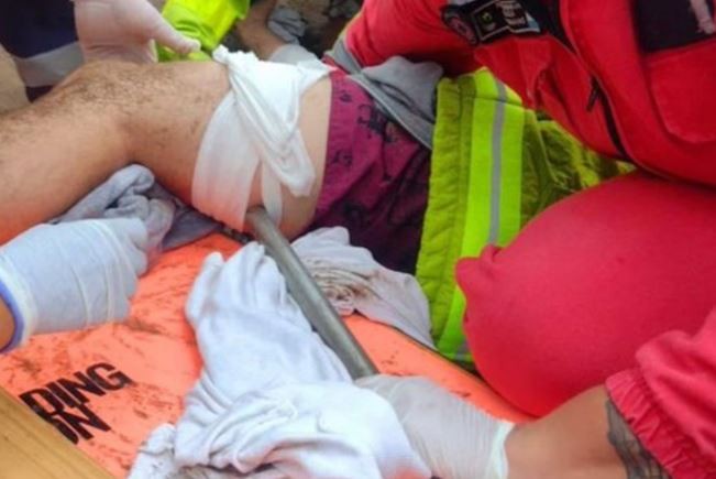 Video | Una sombrilla voló por la playa, se clavó en la pierna de un joven y se la sacaron con una motosierra | Redes