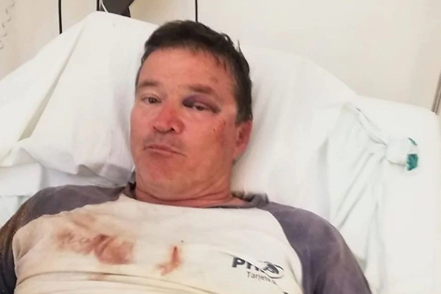 Torturan a un productor rural en Venado Tuerto para robarle | Noticias