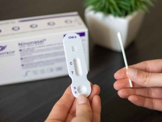 Anmat autorizó el uso de cuatro tests de autoevaluación de Covid | Nacionales