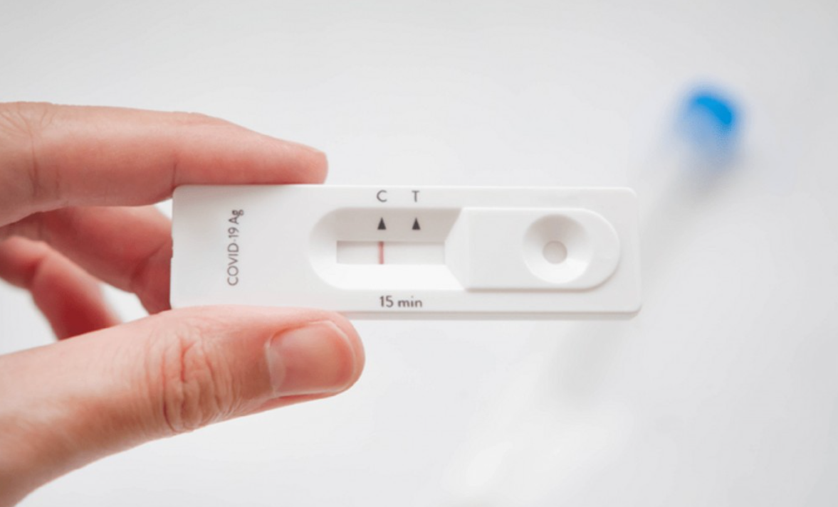 Autotest de Covid-19: estiman que la próxima semana todas las farmacias del país empezarán a venderlos | Información General