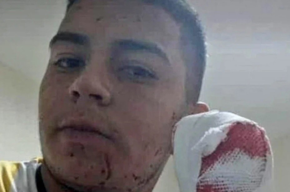 Brutal asalto con un machete a un repartidor de comida: perdió cuatro dedos | Nacionales