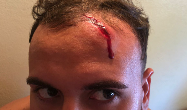 Mapuches atacaron con boleadoras y piedras a turistas que intentaron esquivar un corte en la ruta | Nacionales