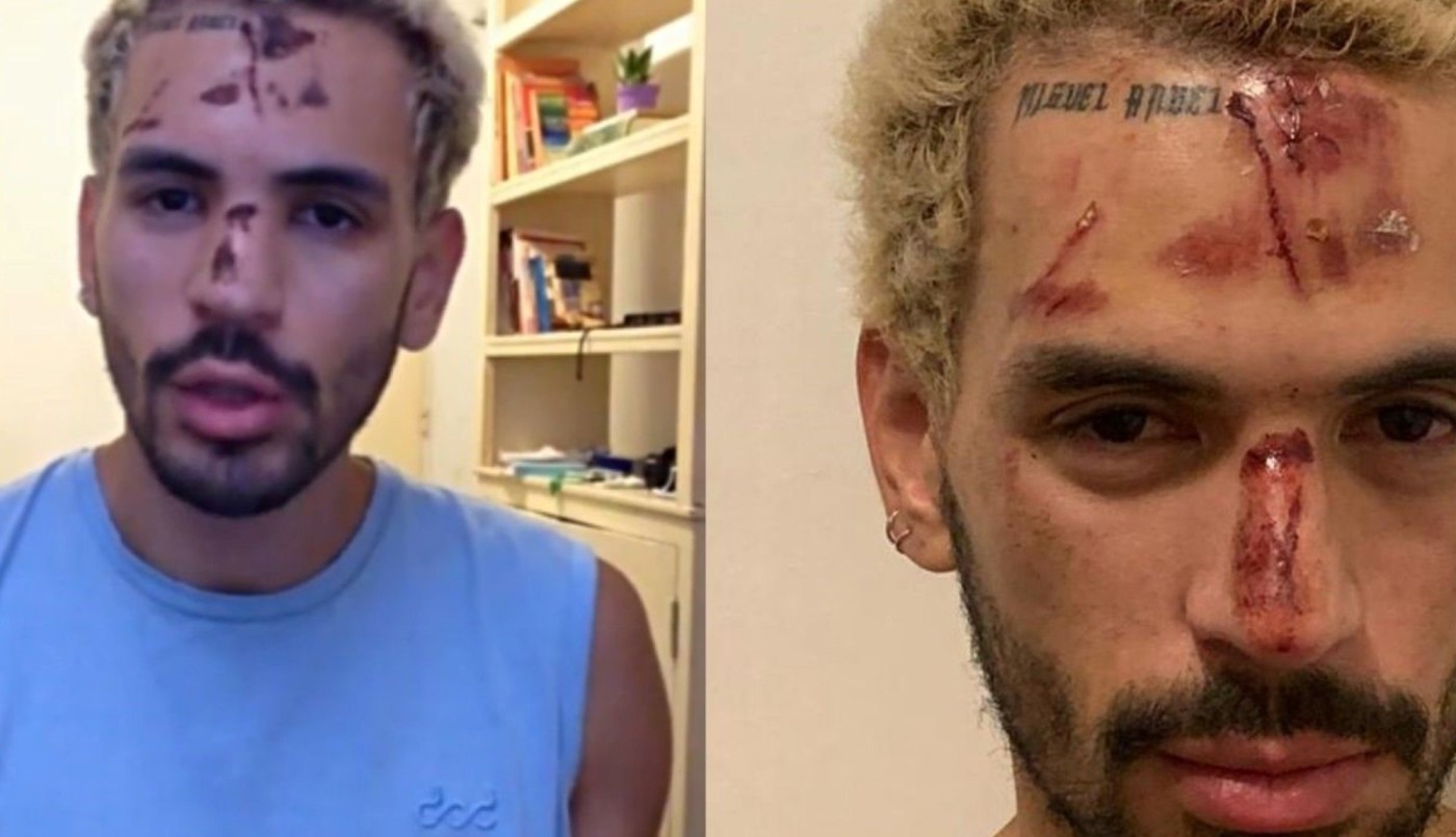 Brutal paliza a un joven por ser gay en un boliche de la costanera porteña | Igualdad y Género