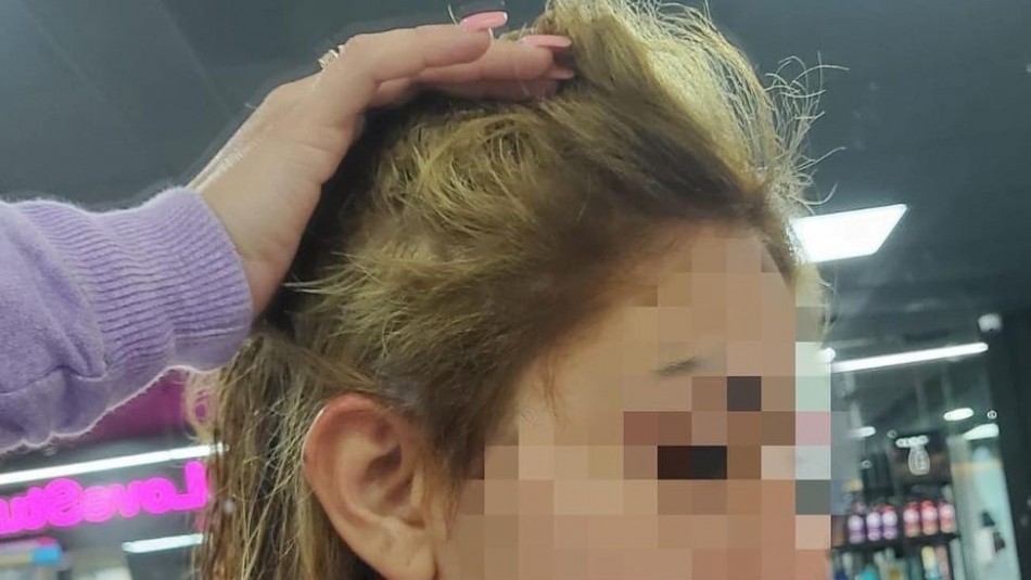 Fue a la peluquería para un cambio de look y se le cayó el pelo: le ofrecieron una peluca como consuelo | Información General