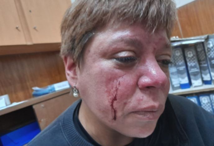 Una inspectora fue agredida en La Plata por los dueños de una hamburguesería | Nacionales