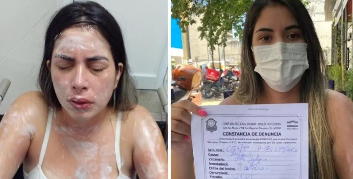 Una mujer acusó a otra de tocarle el espejo del auto, la persiguió y le tiró gas pimienta | Nacionales
