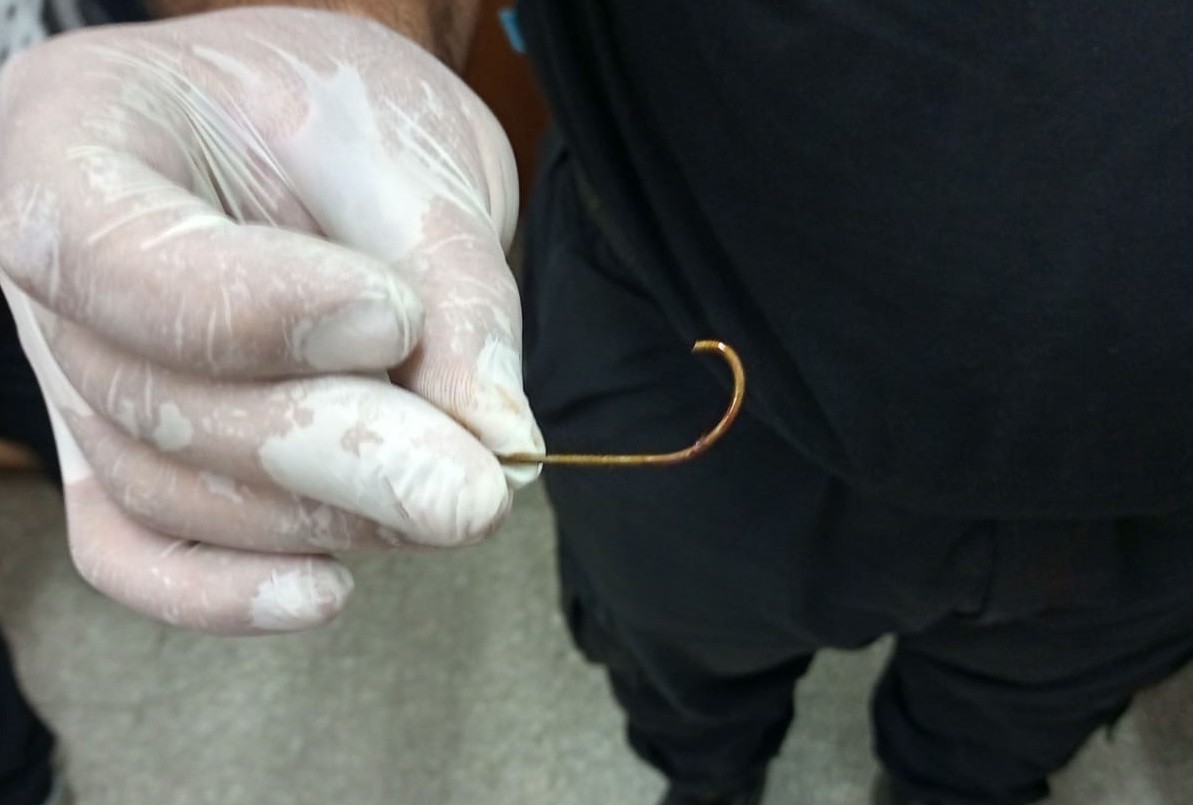 Un pescador torpe se clavó un anzuelo en la nariz y terminó en el hospital | Información General