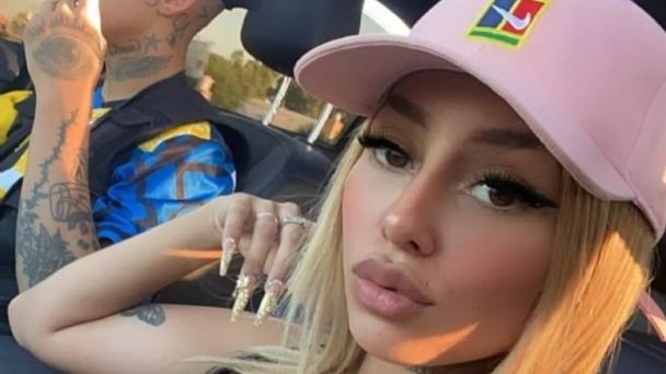 Tamara Báez, la novia de L-Gante, anunció cuál será su próxima cirugía estética | Espectaculos