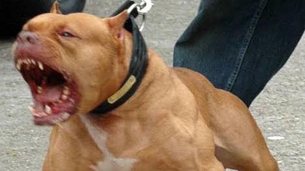 Se peleaban los perros pitbull de su novio, quiso separarlos y terminó internada con graves heridas | Nacionales