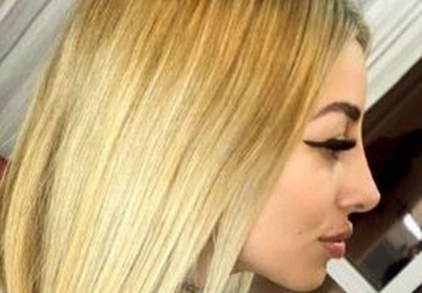 "Quedé como quería": Tamara Baéz, la novia de L-Gante, se realizó otro retoque estético | Espectaculos