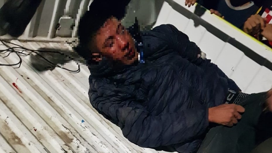 Hartos de la inseguridad, vecinos lincharon y le amputaron dos dedos a un ladrón | Nacionales