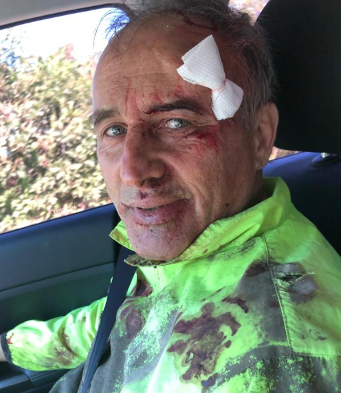 Se accidentó en bici el diputado nacional Baldassi | Legislativas