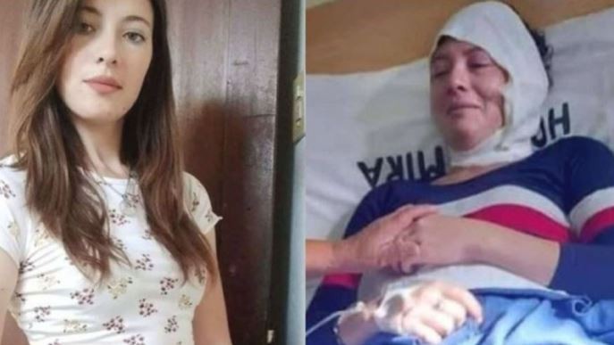 Una mujer fue a buscar la cuota alimentaria de su hijo y su ex marido le tiró aceite hirviendo en la cara | Igualdad y Género