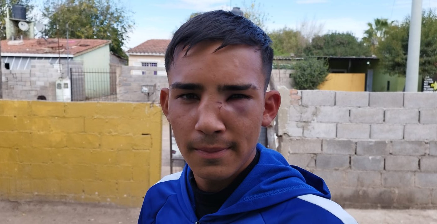 Batalla campal entre menores en un partido de fútbol en Córdoba | Deportes