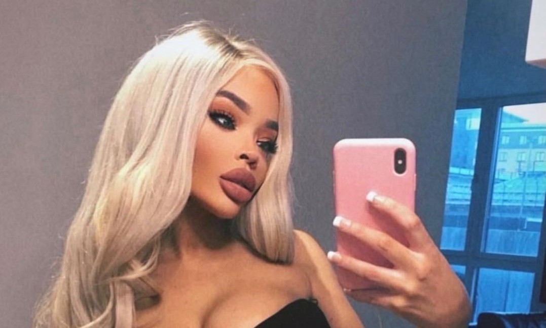 Para parecerse a un filtro de Instagram, gastó 20.000 euros en cirugías | Espectaculos