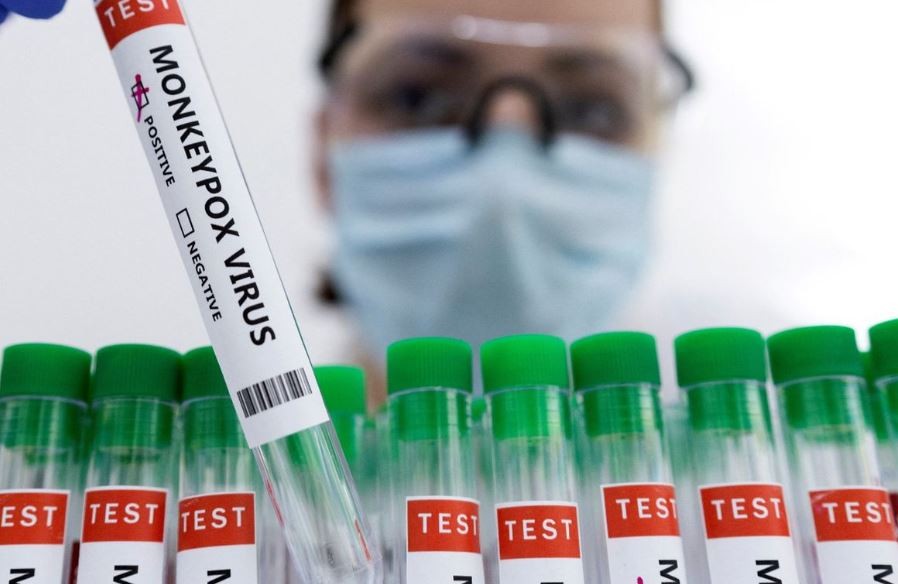 Confirmaron el quinto caso de viruela del mono en la Argentina | Nacionales