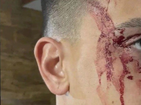 Asaltaron a Agustín Sandez: cuatro detenidos por el ataque al jugador de Boca | Deportes