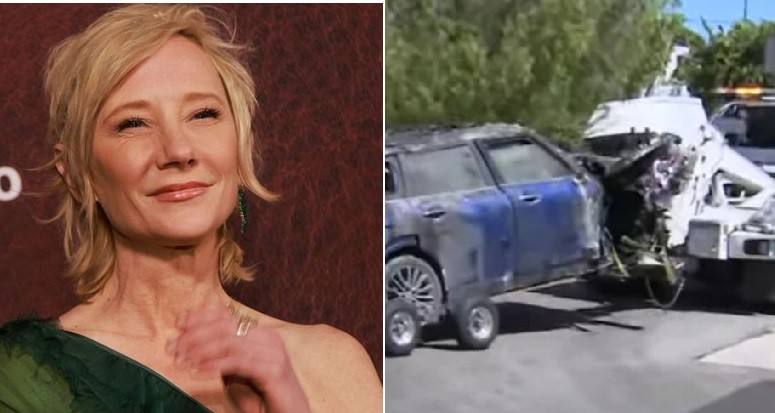 La actriz Anne Heche está en coma tras sufrir un accidente | Espectaculos