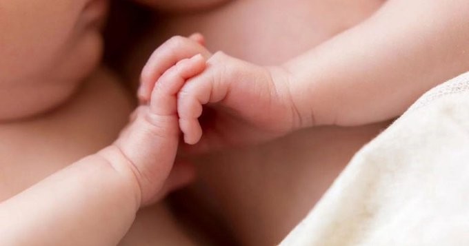 Nacieron bebas siamesas en Córdoba: "Están estables" | Nacionales