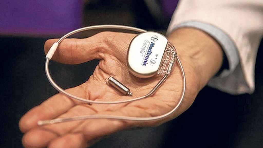 Por primera vez en Argentina, implantan marcapasos del tamaño de una píldora | Nacionales