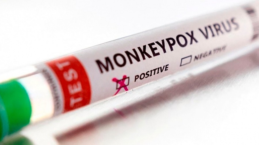 Viruela del mono en Argentina: confirmaron otros 265 casos, un 20% más que la semana anterior | Nacionales