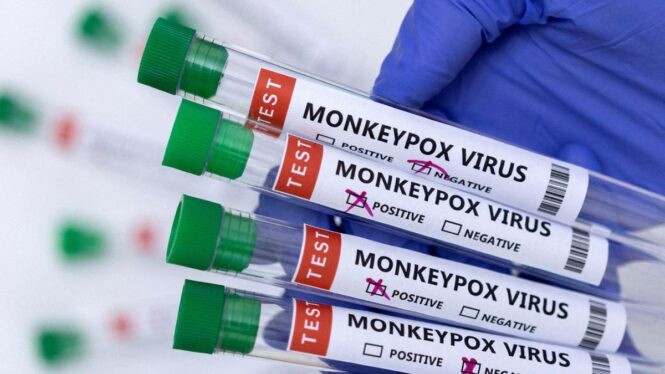Viruela del mono en Argentina: confirman el primer caso infantil y la primera internación en terapia intensiva | Nacionales