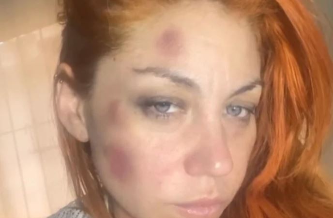 Lourdes, ex cantante de Bandana, denunció a su ex pareja por violencia de género | Espectaculos