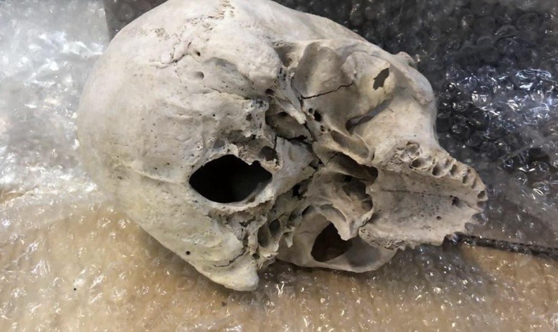 Una calavera y una factura por 295 dólares: el misterio en una encomienda secuestrada por la Aduana | Nacionales