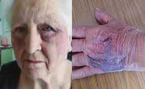 Asaltaron y golpearon a una pareja de jubilados y ahora se quieren ir de su casa | Nacionales