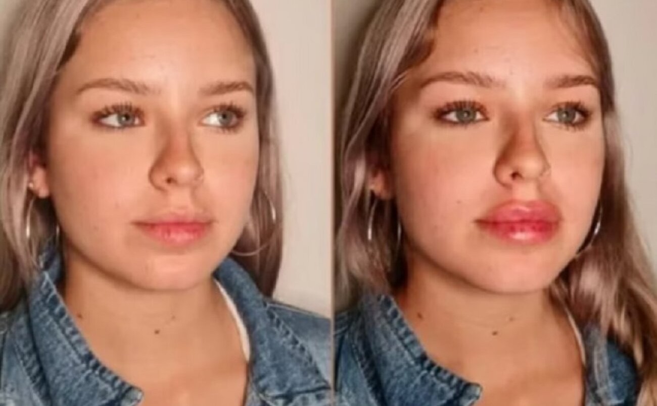 Coti de Gran Hermano se hizo un retoque estético y mostró el resultado | Espectaculos