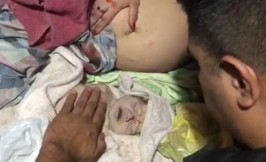 Conmovedor: un policía reanimó a un bebé que había nacido sin signos vitales | Nacionales