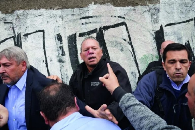 Agresión a Berni: la Justicia porteña identificó a más atacantes y podría haber nuevas detenciones | Nacionales