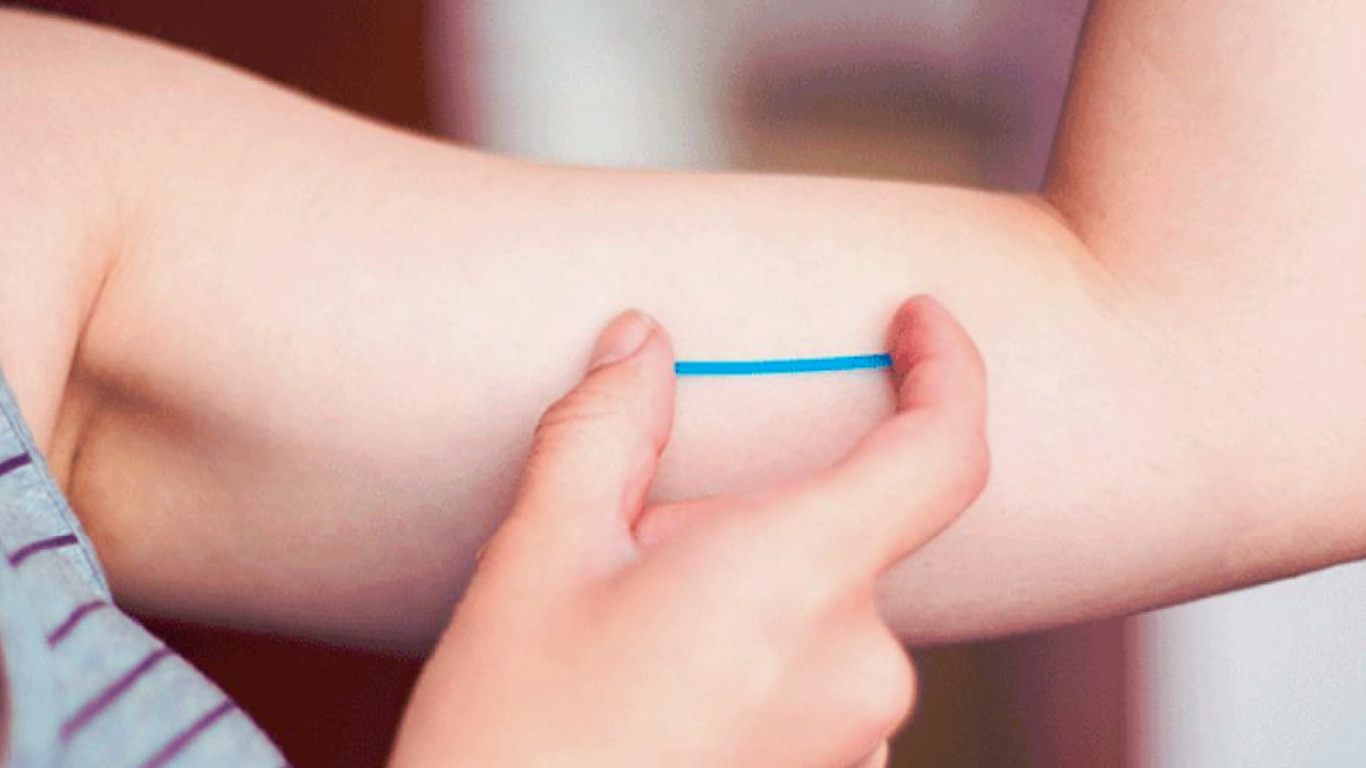 Salta: Colocarán implantes subdérmicos anticonceptivos a mujeres de hasta 19 años | Igualdad y Género