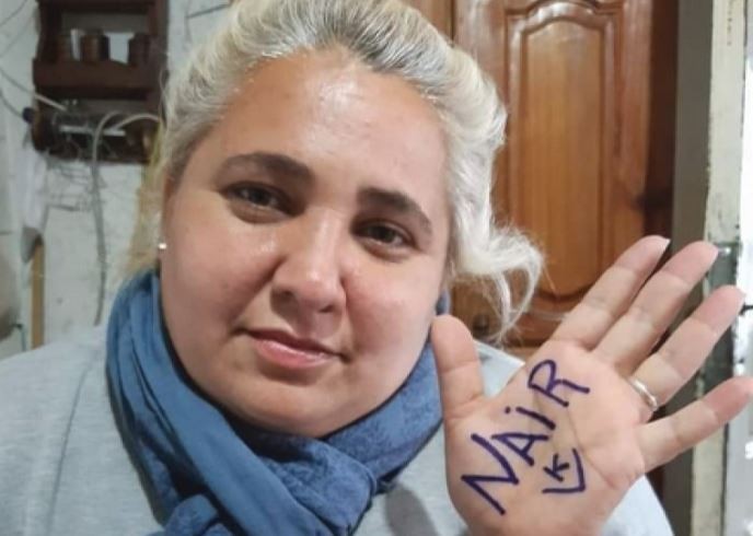 Una concejal de Quilmes fue internada en grave estado tras un confuso episodio con su pareja: ambos tienen quemaduras | Nacionales