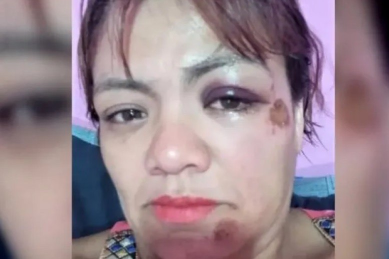 Contó en redes que fue atacada por una jauría y que la Policía no quiso tomarle la denuncia | Redes