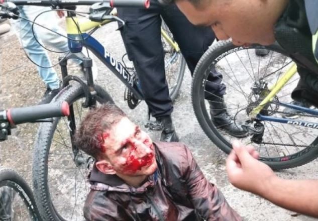 Vecinos detuvieron a un motochorro y descubrieron que era un policía | Nacionales