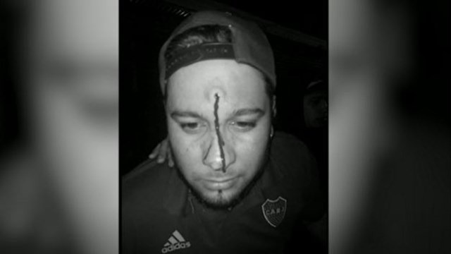 El grupo de cumbia tocaba en la calle y el cantante recibió un disparo en la frente | Noticias