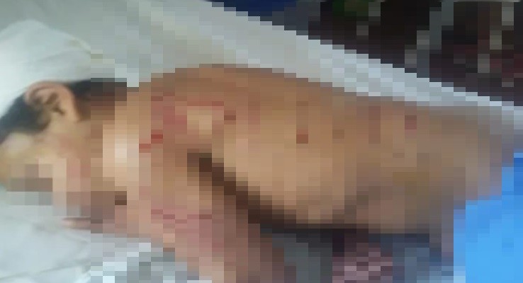 "Pensé que lo mataban": una jauría atacó a un nene de 9 años | Nacionales