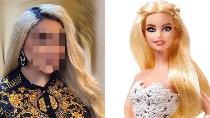 Impactante: se hizo 43 cirugías para parecerse a Barbie | Redes