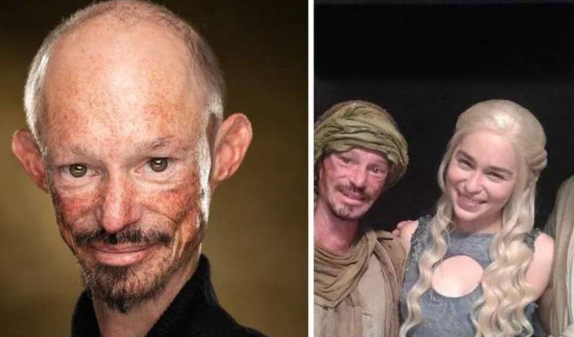 Murió a los 36 años Darren Kent, actor de "Games of Thrones" | Espectaculos