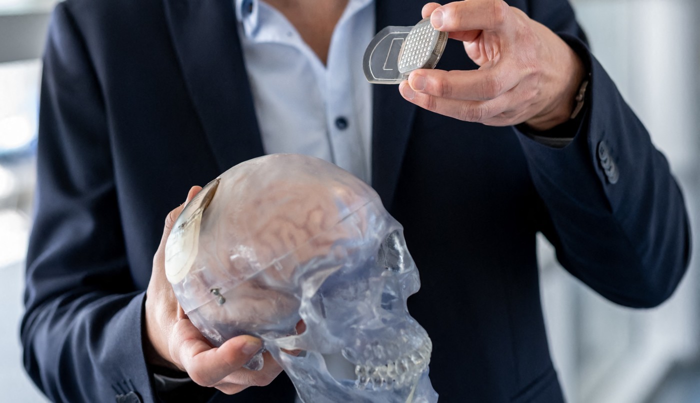 Implantes cerebrales: la carrera hacia el cíborg cobra impulso | Tecnología