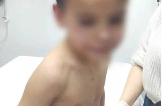 Le disparó a un nene de seis años tras una pelea que había tenido con su papá en un partido de fútbol amateur | Nacionales