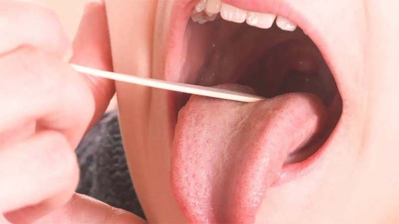 Aumentan los casos invasivos por estreptococo y advierten importancia de no subestimar los síntomas | Salud