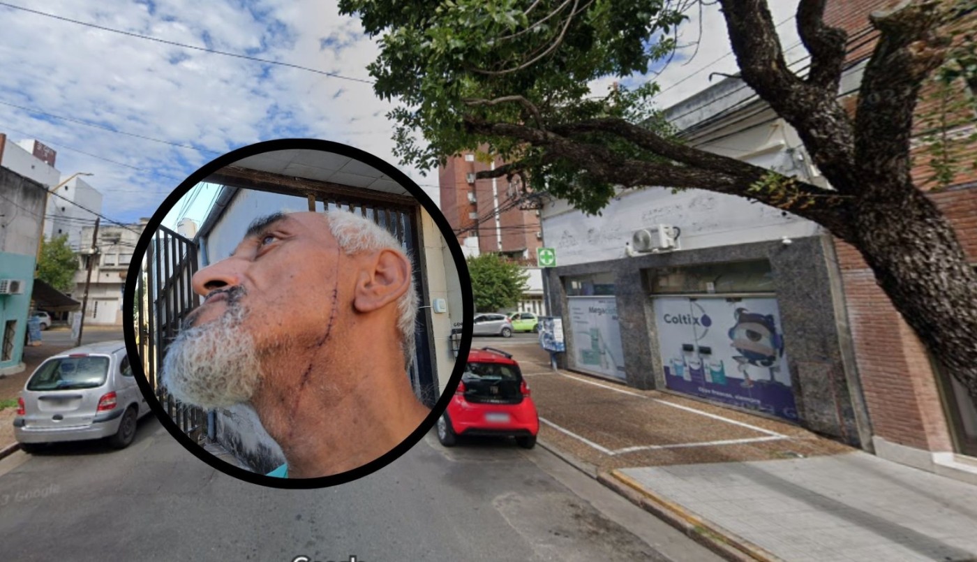 Asaltaron a un cadete y le cortaron la cara con una navaja | Noticias