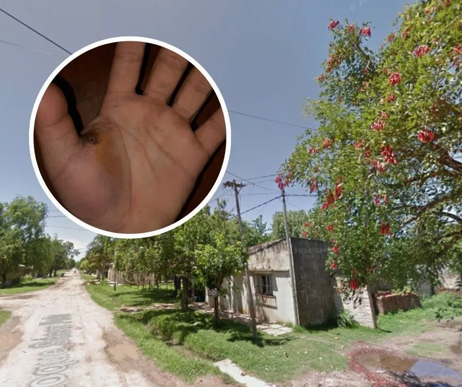 Santo Tomé: en un intento de robo le balearon la mano a un joven | Policiales