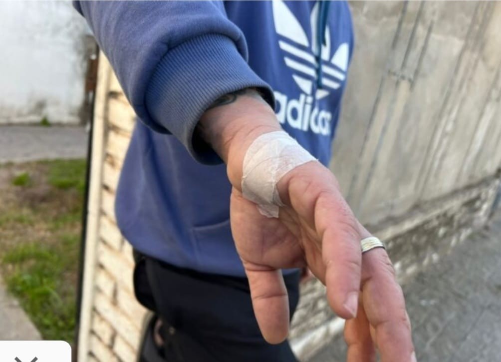 Ladrón hirió a joven cuando lo descubrió robando | Policiales