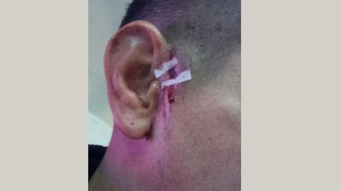 Habló el jugador herido: "Faltan un montón de controles en la Liga Santafesina" | Deportes