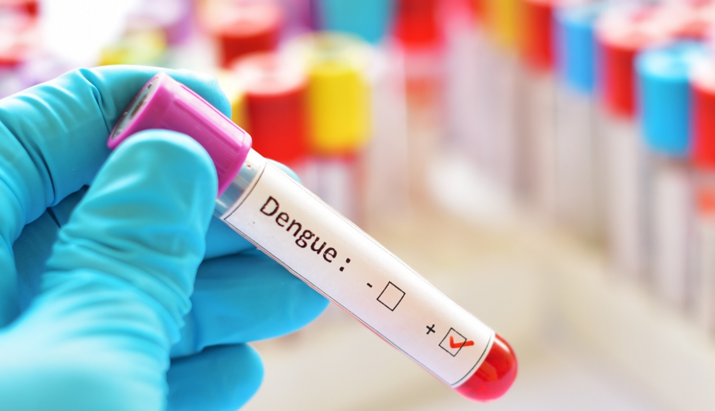 Anmat aprobó un nuevo kit para conocer el diagnóstico de dengue | Información General